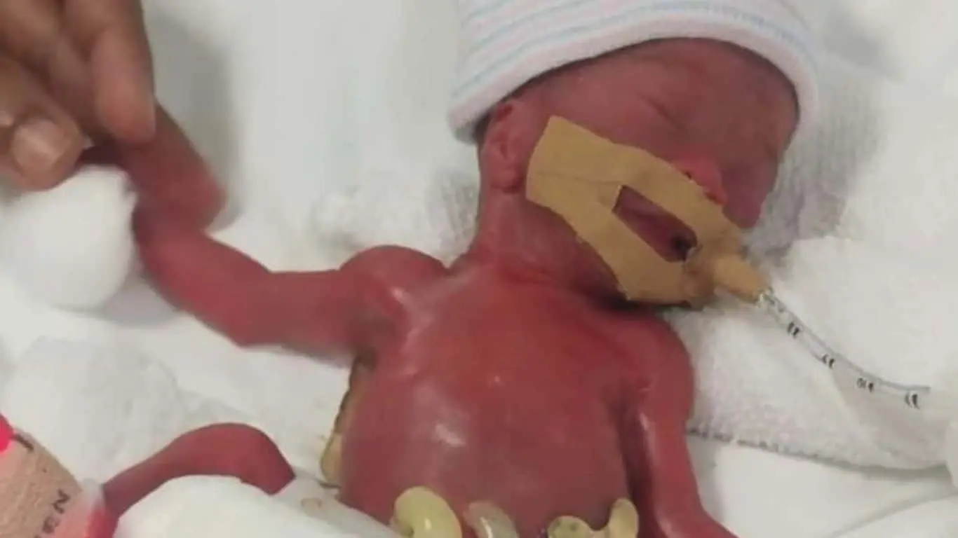 Major Historical Events on February 27- Today in History - World's Smallest Baby (2019)